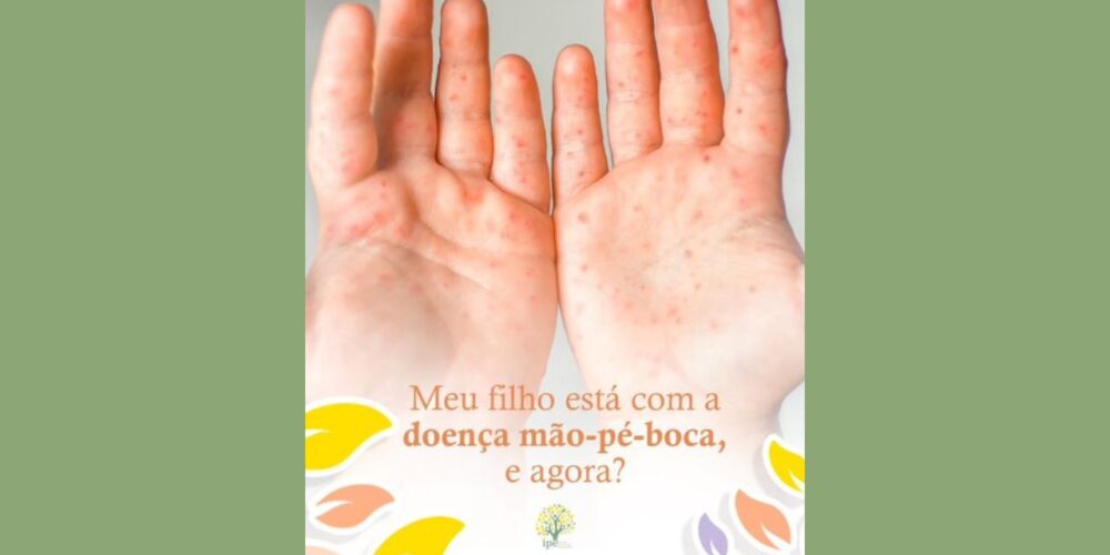 doença mão, pé e boca
